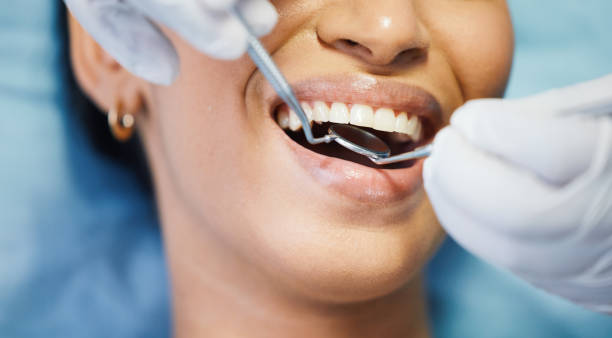 Best Chipped Tooth Repair Near Me  in Mason, TX